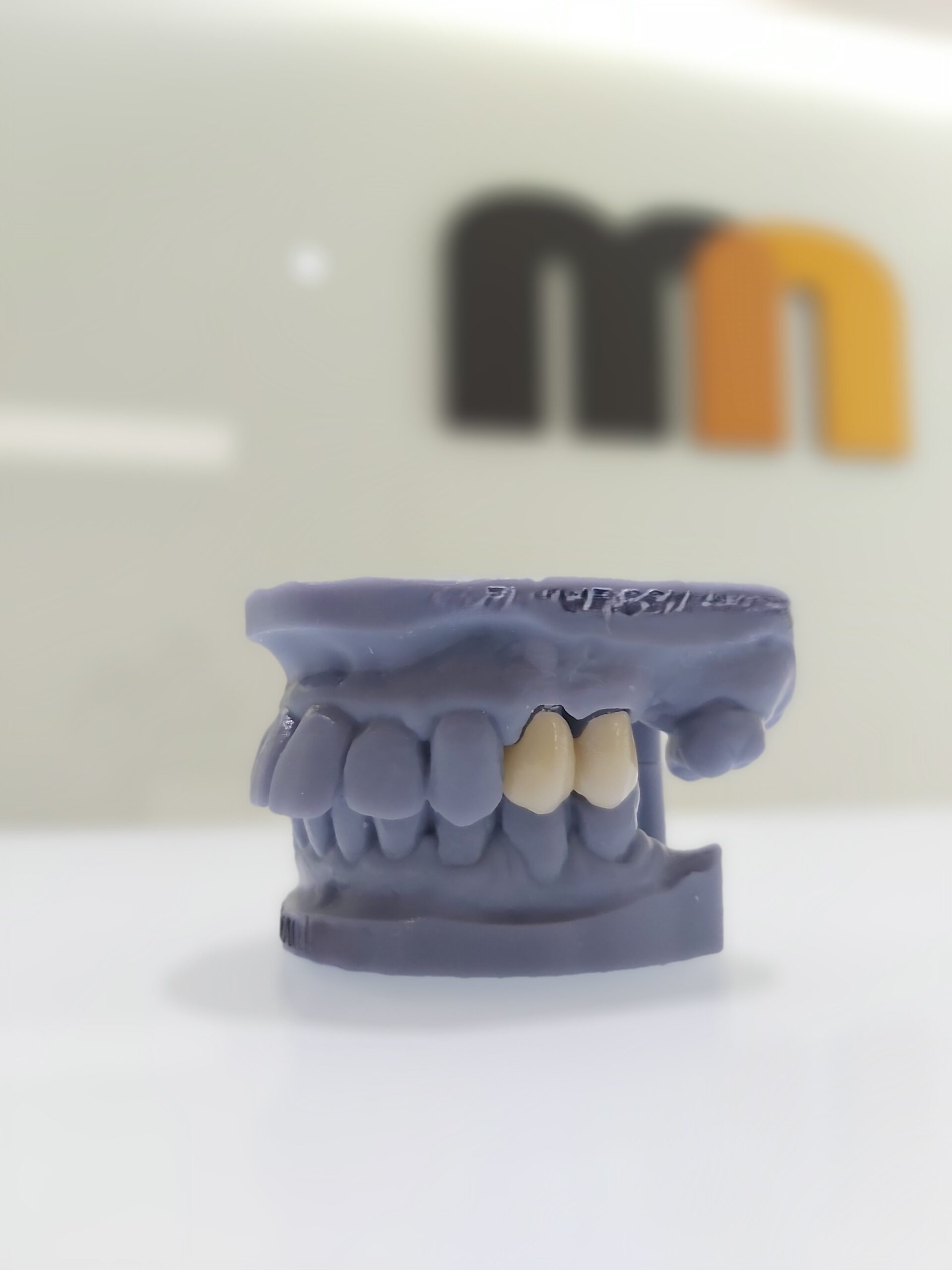 Prótesis sobre implantes, Clínica Martínez Navarro